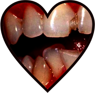 teeth_heart emote for Discord