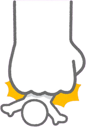 paunched emote for Discord