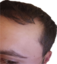 allenhairline emote for Discord