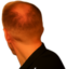 alopeciaJake emote for Discord