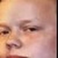 AlbinBruh emote for Discord