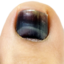 blacktoenail emote for Discord