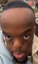 bigoldforehead emote for Discord