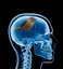 BirdBrain emote for Discord