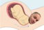 emoneyMiracleOfChildbirth emote for Discord