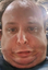 FeranzyChin emote for Discord
